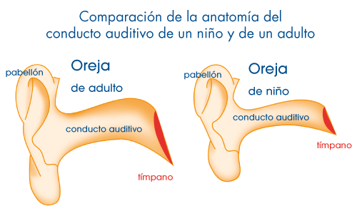 A Cerumen A Cerumen Y Los Ninos